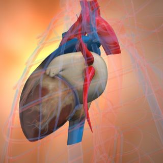 Rinforzo delle Pareti Vascolari